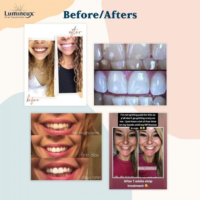 Lumineux Teeth Whitening Strips by Oral Essentials BoldProducts