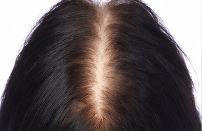 Before: female part line comparison