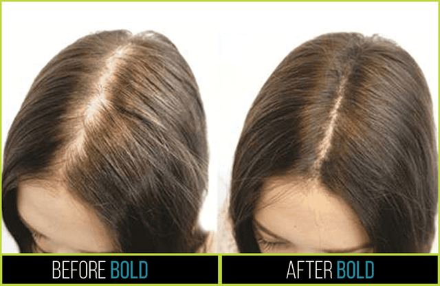 Before-and-after example of hair-fiber coverage along a part line