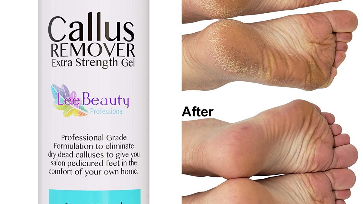 Lee Beauty Professional Callus Remover Extra Strength Gel for Feet, At Home  Pedicure Results, 8 Oz 