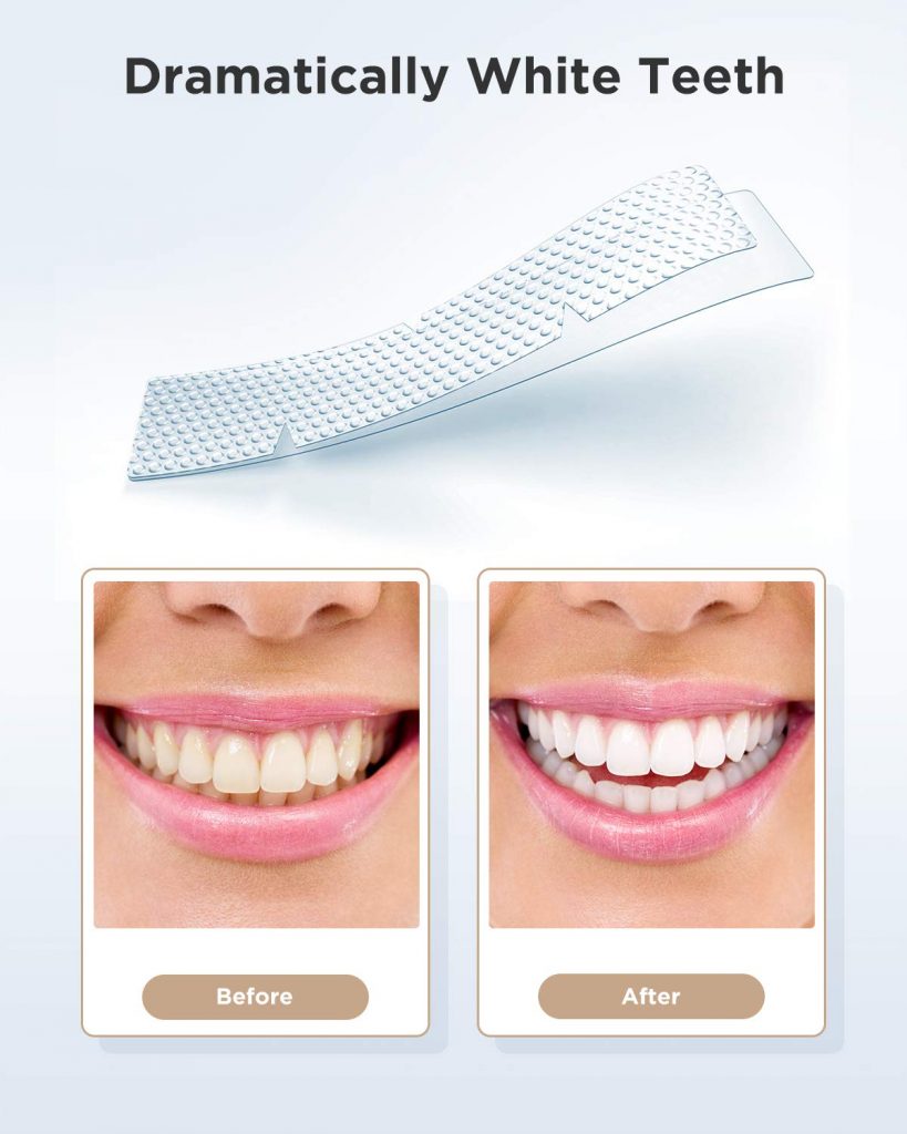 Fairywill Teeth Whitening Strips For Sensitive Teeth BoldProducts USA