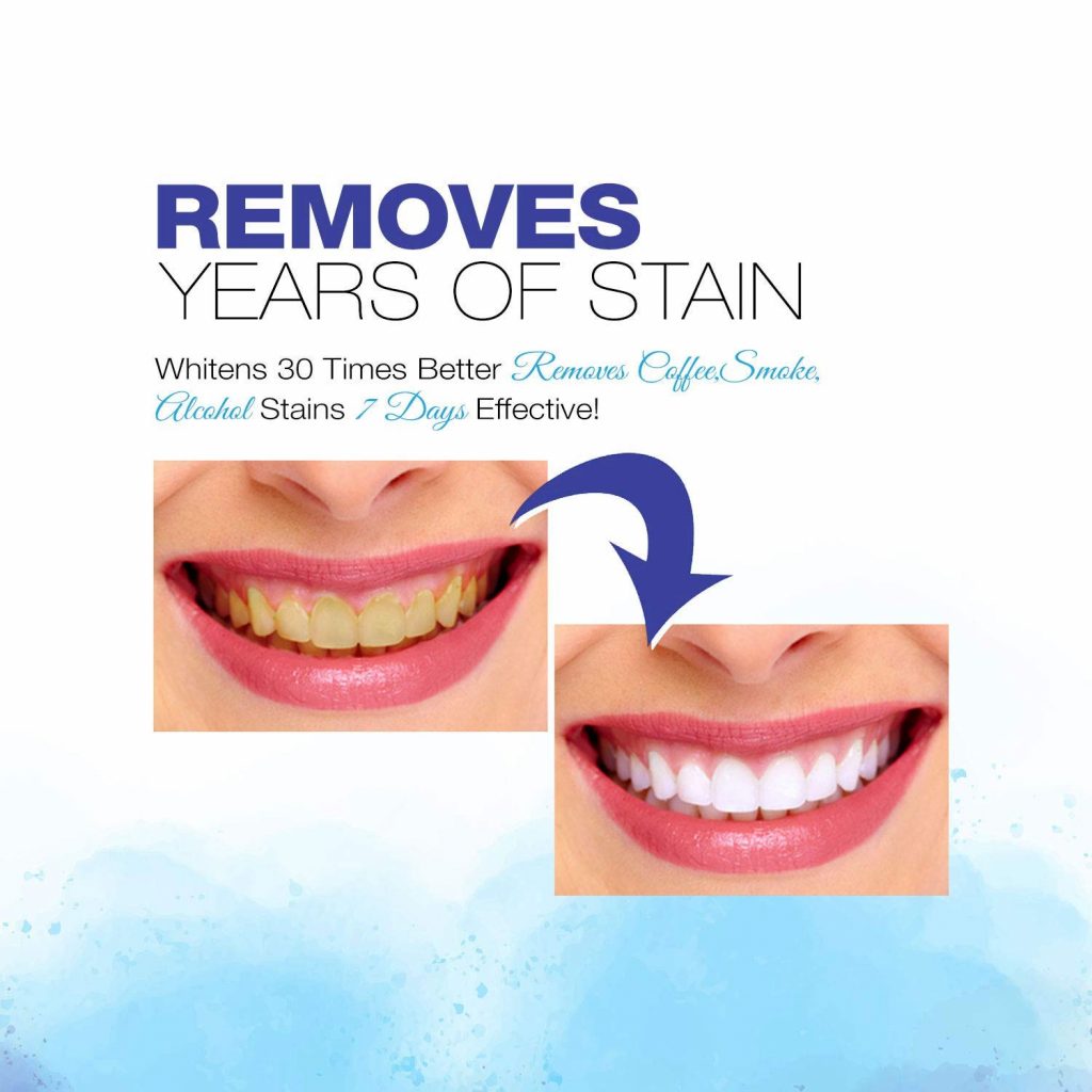 Viebeauti Teeth Whitening Pen 2 Pcs BoldProducts USA