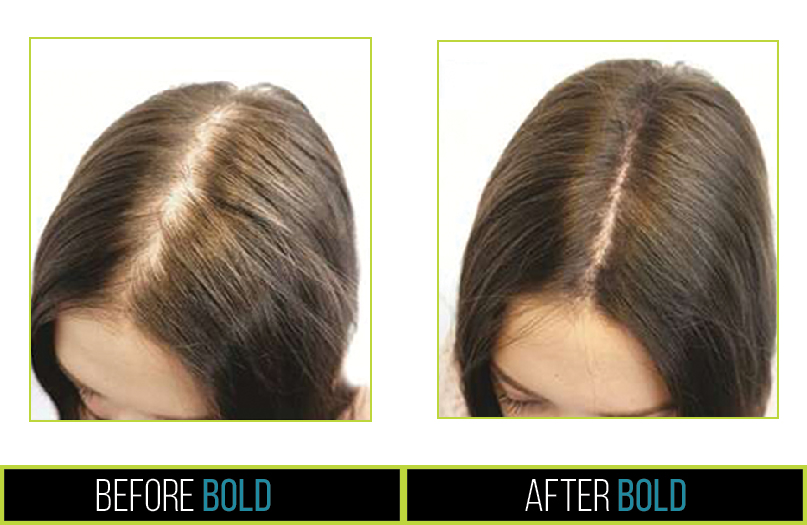 BoldHairFibersStarterLimitedTimeOffer ⋆ BoldProducts USA